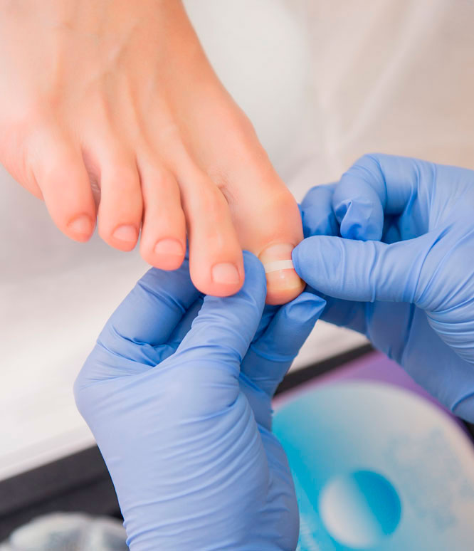 Протезирование и восстановление ногтевой пластины